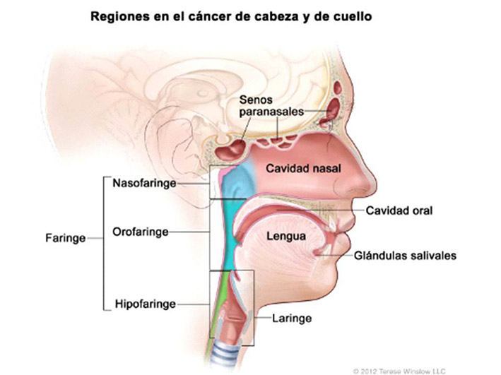 Cáncer de cabeza y cuello