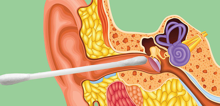 La otitis también es frecuente en invierno